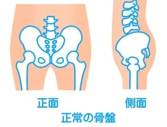 骨盤正常