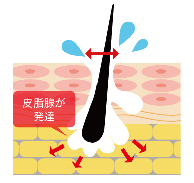 毛穴_開き