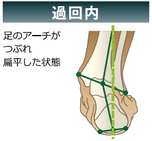 過回内