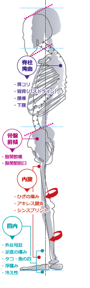 足部機能不全が及ぼす全身への影響