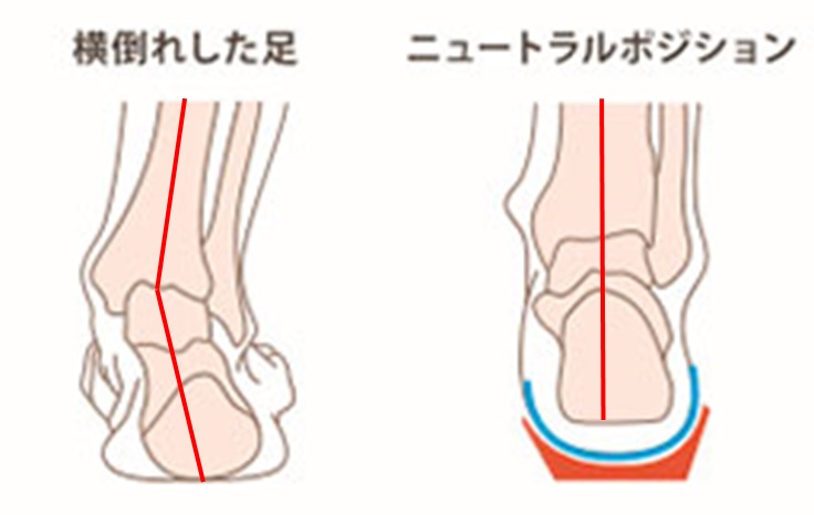 オーソティクス③