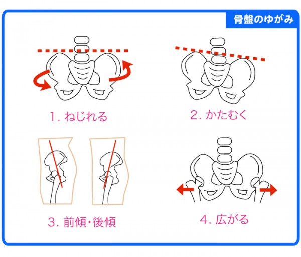 骨盤歪み２