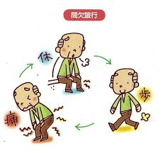 間欠性破行
