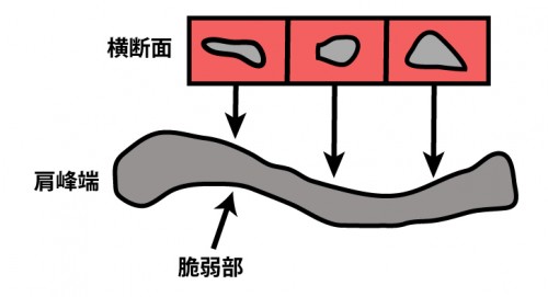 鎖骨部の脆弱ポイント